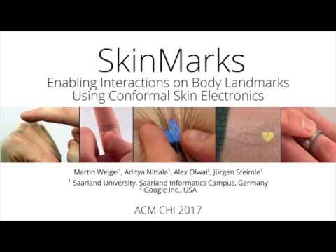 SkinMarks: Enabling Interactions on Body Landmarks